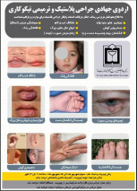 اردوی جهادی جراحی پلاستیک و ترمیمی نیکوکاری